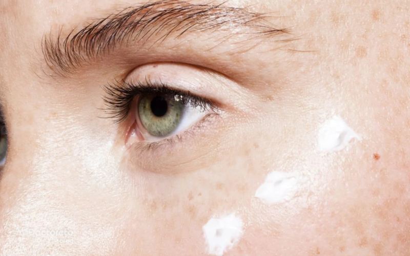 تصویر اصلی مطلب: نکاتی که باید درباره کرم دور چشم بدانید