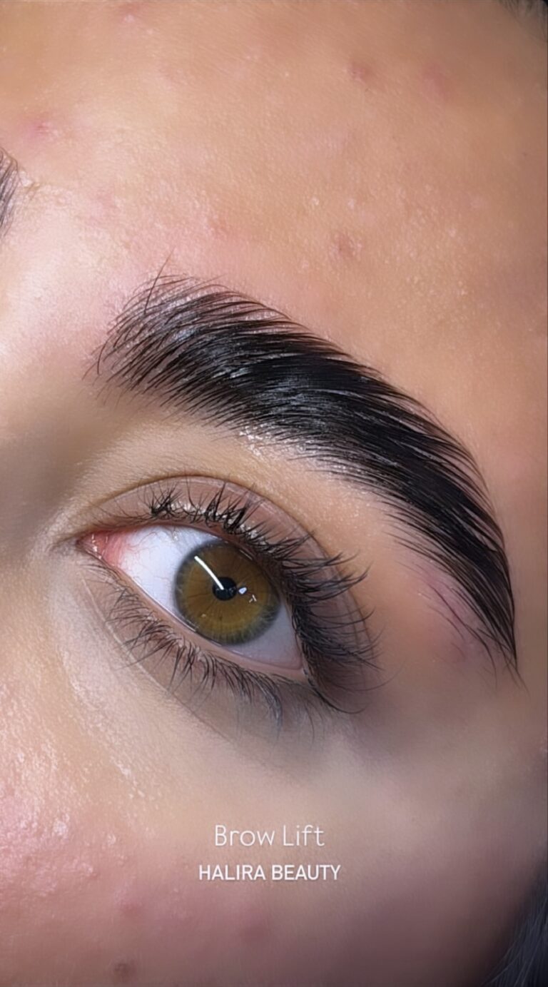 لیفت ابرو و مژه - گالری 4