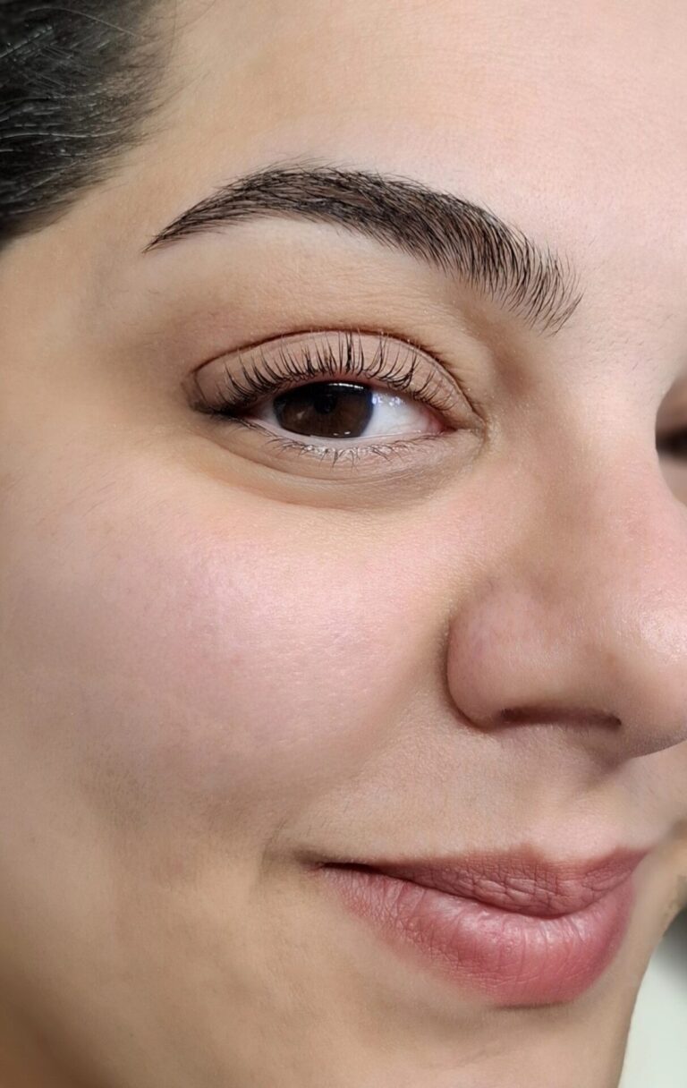 لیفت ابرو و مژه - گالری 1